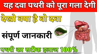 पथरी का पक्का इलाज।। यह दवा पथरी को पूरा गला देगी।। Treatment For Gall Bladder Stone [upl. by Follansbee]