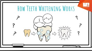 How Teeth Whitening Works [upl. by Georgia]