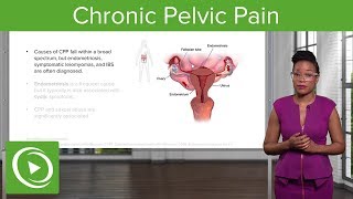 Chronic Pelvic Pain CPP Definition Diagnosis amp Management – Gynecology  Lecturio [upl. by Xonel]