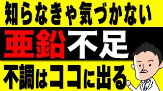 【栄養学】こんな症状が出たら要注意！亜鉛不足になると起こる不調と亜鉛が効率よく摂れる食べ物 [upl. by Zosi]