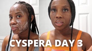 Cyspera Cysteamine Day 3  My Daily Melasma  Hyperpigmentation Skin Care Routine [upl. by Aphra]