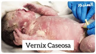 Vernix Caseosa ماده تحمى الطفل اثناء الولادة [upl. by Ruiz430]