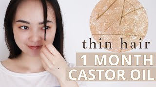 30 Days of Castor Oil on My Thin Hair [upl. by Pare]