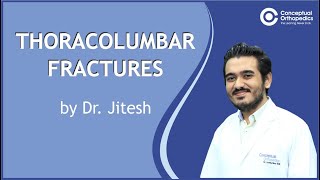 Thoracolumbar Fracture amp Management ConceptualOrthopedics [upl. by Acinahs]