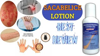 Scabelice Lotion Uses  Scabies Khujli Scabicide  Gamma Benzene Hexachloride amp Cetrimide [upl. by Dorolisa]