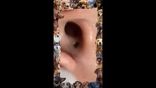 Blackhead Removal  12 Blackhead extraction  Ear blackhead  blackheads [upl. by Debo925]