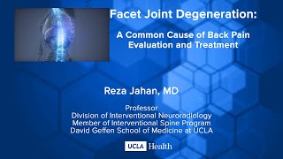 Facet Joint Degeneration A Common Cause of Back Pain Evaluation and Treatment [upl. by Atikahs]