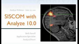 SISCOM with Analyze 100  Webinar [upl. by Iseabal]