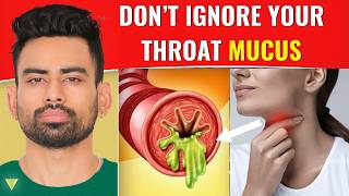 How to Clear Excess Throat Mucus [upl. by Fatsug]