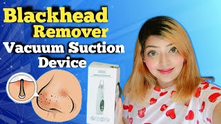 How To Use Blackhead Vacuum Suction Machine  blackhead pore vacuum  Does it Work [upl. by Akimyt]