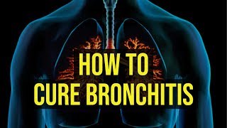 How To Cure Bronchitis Fast  5 Quick Ways [upl. by Ajax]