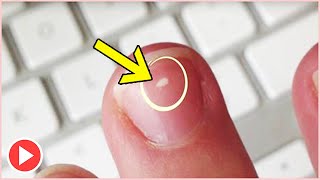 How To Get Rid Of White Spots On Nails Within 7 Days  Nail Treatments [upl. by Aneeuqahs]