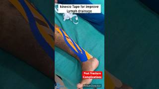 Kinesio taping for improve lymphatic drainage How to reduce edema kinesiotape kinesiotherapy [upl. by Juanita]