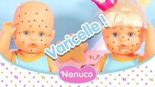 Nenuco Mon Premier Rhume atil la varicelle 🔴 Il faut soigner les bébés avec la malette de docteur [upl. by Nesline]