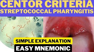 Centor Criteria for Group A Streptococcal Pharyngitis  Easy Mnemonic  Simple Explanation [upl. by Henriques]