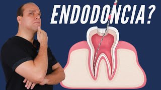 Qué es una ENDODONCIA 🚨  ¿DUELE ¿Cuándo la NECESITO  🚨 [upl. by Anitnoc]