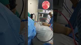 Endoscopic polyp surgery song hindisong polyp endoscopicsurgery [upl. by Lefty]