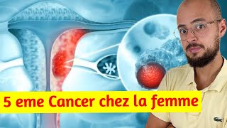 Cancer de lendomètre  le symptôme quil faut ABSOLUMENT connaitre [upl. by Andrea]