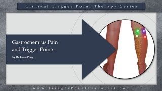 Gastrocnemius Pain and Trigger Points [upl. by Borek]