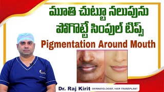 మూతి చుట్టూ నలుపు  How to Get Rid of Pigmentation Around Mouth  Celestee Skin And Hair Clinic [upl. by Maguire471]