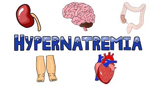 An Approach to Hypernatremia  Hypernatremia Diagnostic Algorithm  Hypernatremia Causes MADE EASY [upl. by Bergren]