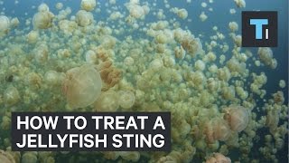 How to treat a jellyfish sting [upl. by Harret]