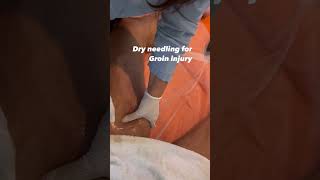 Fast Track to Recovery  Dry Needling for Groin Injuries shorts [upl. by Kreiker370]