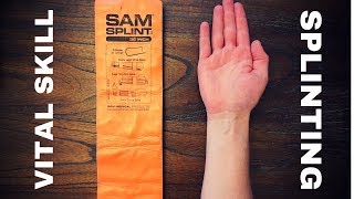 Fundamentals of Splinting [upl. by Notlrahc]