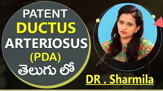 Patent Ductus Arteriosus PDA performed on Premature Baby in Telugu  Sr Pediatrician Dr Sharmila [upl. by Iggep]