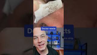 Derm reacts to incredibly satisfying pore strip removal dermreacts porestrip blackheads [upl. by Knick]