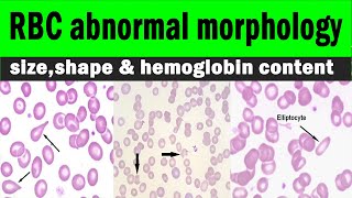 Red blood cells  RBC abnormal morphology  sizeshape amp hemoglobin content  Hematology [upl. by Rika]