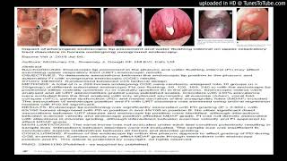 Pharyngeal endoscopy tip placement and water flushing interval on upper respiratory tract disorders [upl. by Idnir]