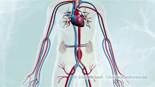 CIRURGIA ENDOVASCULAR DE ANEURISMA DA AORTA ABDOMINAL [upl. by Bobina]