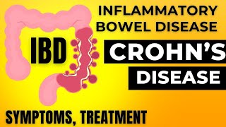 Inflammatory bowel disease  Corhns disease treatment  IBD symptoms and treatment in Hindi [upl. by Amaty172]