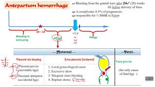 Antepartum hemorrhage  part 1 [upl. by Lentha]