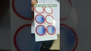 Slide Agglutination test [upl. by Solis]