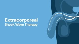 Extracorporeal Shock Wave Therapy ESWT for Erectile Dysfunction [upl. by Nivra276]