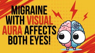 Migraine With Visual Aura Affects BOTH Eyes [upl. by Leira]