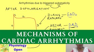 Mechanisms of cardiac arrhythmias  Tachyarrhythmias  Cardiovascular Pathophysiology [upl. by Hallee877]