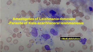 Amastigotes of Leishmania donovaniin Slit Skin Smear [upl. by Algie278]