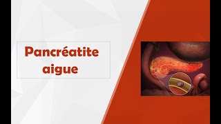 Pancréatite aigue [upl. by Jacinto]