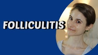 WHAT IS CAUSING MY FOLLICULITIS QampA WITH DERMATOLOGIST DR DRAY [upl. by Meeharb157]