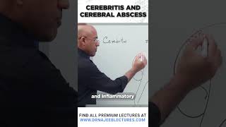 Cerebritis And Cerebral Abscess drnajeeb drnajeeblectures shortvideostatus [upl. by Aimak320]