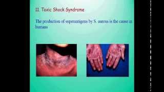 Gram positive cocci StaphylococcusStreptococcusMicrococcus Greasy pig diseasepyoderma of dogs [upl. by Itak477]