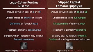 Legg–Calve–Perthes Disease vs Slipped Capital Femoral Epiphysis [upl. by Samuelson358]