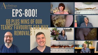 OUR STAFFS FAVOURITE EAR WAX REMOVALS  EP800 [upl. by Cyprio]