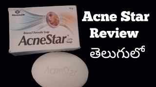 Acne Star Soap Review Telugu [upl. by Sixel57]