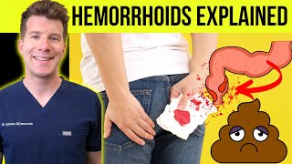 Doctor explains HEMORRHOIDS aka piles  Causes symptoms treatment amp prevention [upl. by Cozza]