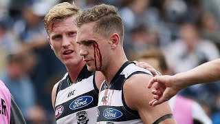 NEW AFL  Best Bumps Tackles and Injuries from Rounds 1723 in the 2021 Season [upl. by Ayisan]