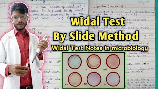 Widal test by Slide Method in hindiwidal test notes in microbiology widaltest [upl. by Immij]